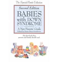 Babies With Down Syndrome