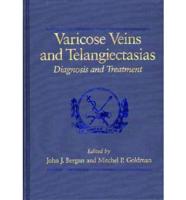 Varicose Veins and Telangiectasias