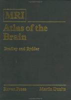 MRI Atlas of the Brain