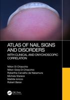 Atlas of Nail Signs and Disorders With Clinical and Onychoscopic Correlation