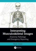 Interpreting Musculoskeletal Images