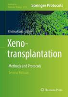 Xenotransplantation