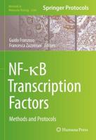 NF-kB Transcription Factors