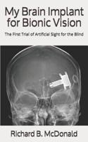 My Brain Implant for Bionic Vision