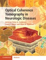 Optical Coherence Tomography in Neurological Diseases