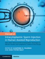 Manual of Intracytoplasmic Sperm Injection in Human Assisted Reproduction