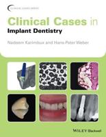 Clinical Cases in Implant Dentistry