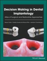 Decision Making in Dental Implantology