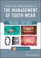 Practical Procedures in the Management of Tooth Wear