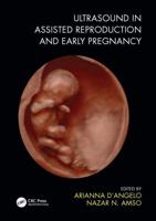 Ultrasound in Assisted Reproduction and Early Pregnancy