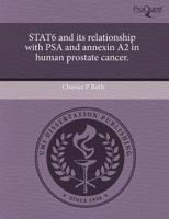 Stat6 and Its Relationship With Psa and Annexin A2 in Human Prostate Cancer