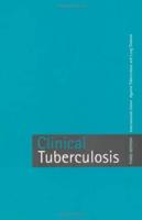 Crofton's Clinical Tuberculosis