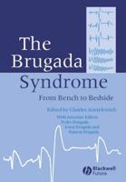 The Brugada Syndrome