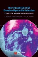 The 12-Lead ECG in ST Elevation Myocardial Infarction