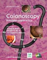 Colonoscopy