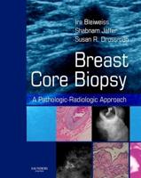 Breast Core Biopsy
