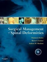 Surgical Management of Spinal Deformities