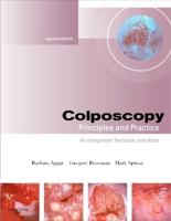 Colposcopy, Principles and Practice