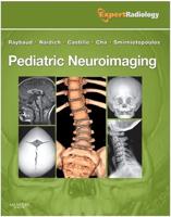 Pediatric Neuroimaging