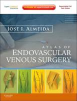 Atlas of Endovascular Venous Surgery