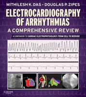 Electrocardiography of Arrhythmias