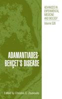 Adamantiades-Behçet's Disease