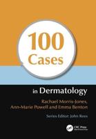 100 Cases in Dermatology
