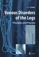 Venous Disorders of the Legs