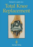 Total Knee Replacement