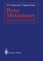 Bone Metastases : Diagnosis and Treatment