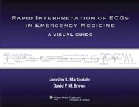 Rapid Interpretation of ECGs in Emergency Medicine