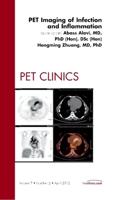 PET Imaging of Infection and Inflammation