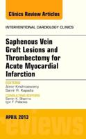 Saphenous Vein Graft Lesions and Thrombectomy for Acute Myocardial Infarction, An Issue of Interventional Cardiology Clinics