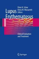 Lupus Erythematosus : Clinical Evaluation and Treatment