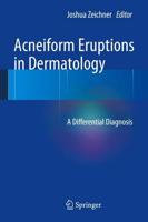 Acneiform Eruptions in Dermatology