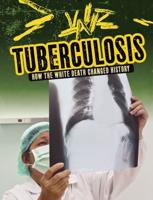 Tuberculosis