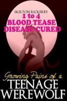 Growing Pains of a Teenage Werewolf Books 1 to 4