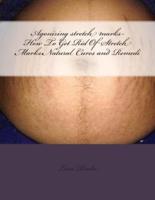 Agonizing Stretch Marks-How to Get Rid of Stretch Marks