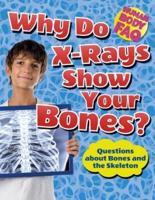 Why Do X-Rays Show Your Bones?