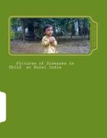 Pictures of Diseases in Child at Rural India