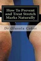 How To Prevent and Treat Stretch Marks Naturally
