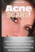 Acne Scars!