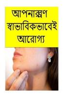 Cure Your Acne Naturally (Bengali)