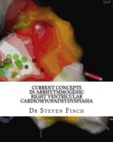 Current Concepts in Arrhytmmogenic Right Ventricular Cardiomyopathydyspiasia