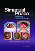 Bimanual Phaco