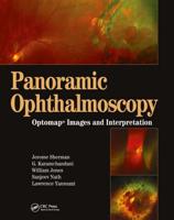 Panoramic Ophthalmoscopy