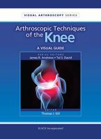 Arthroscopic Techniques of the Knee