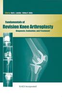 Fundamentals of Revision Knee Anthroplasty