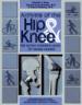 Arthritis of the Hip & Knee