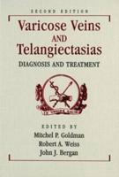 Varicose Veins and Telangiectasias